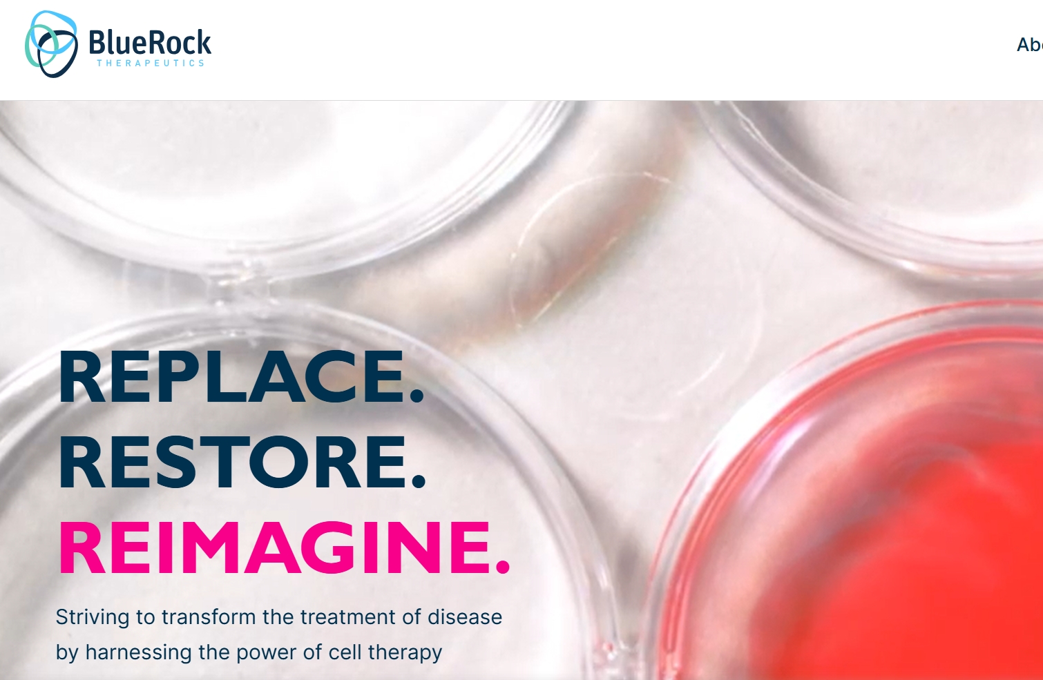 拜耳突破性干細(xì)胞治療帕金森病III期臨床試驗(yàn)啟動，開啟治療新紀(jì)元！