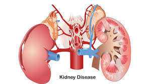 減輕負擔,延長生命:干細胞療法對降低腎病透析并發癥的影響評估