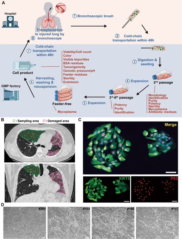 圖1：從IPF患者中分離的P63+肺祖細(xì)胞的克隆和表征。