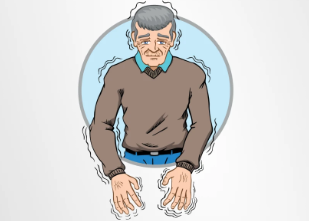 從短期緩解到長(zhǎng)期穩(wěn)定：干細(xì)胞移植治療帕金森病的療效持續(xù)時(shí)間研究