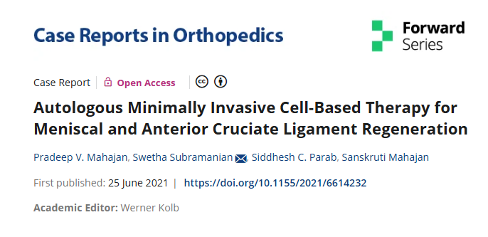 自體微創(chuàng)細(xì)胞療法治療半月板和前交叉韌帶再生