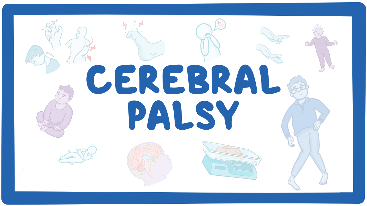 孩子腦癱有救了？神經干細胞移植治療腦癱的真實療效分享