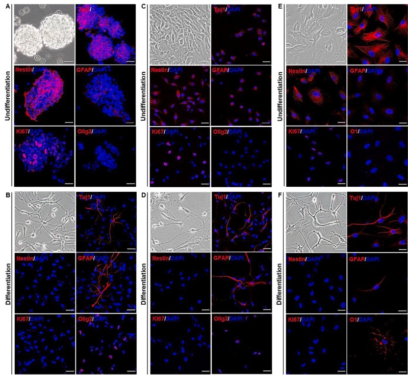 圖1：同基因、同種異體和異種NSC的表征