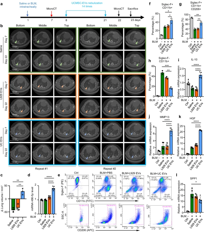 圖3：EVs在肺纖維化治療中的作用。