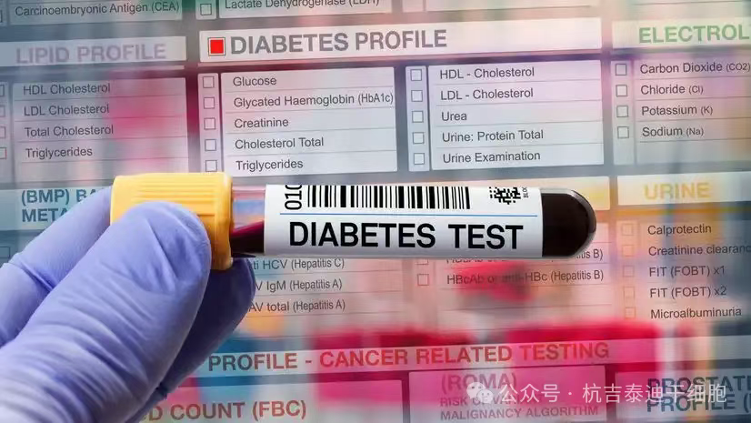 突破性干細胞療法Zimislecel：83%重癥糖尿病患者停用胰島素超一年