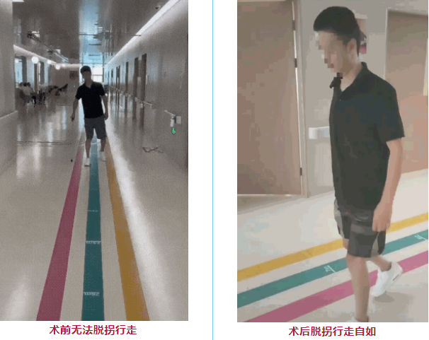 干細(xì)胞治療脊髓損傷臨床項(xiàng)目 干細(xì)胞治療脊髓損傷臨床項(xiàng)目