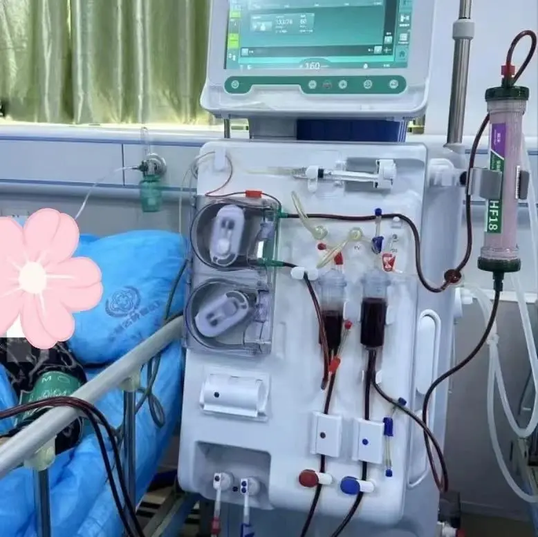 單針交互透析技術