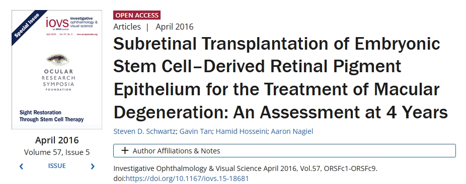 胚胎干細(xì)胞來(lái)源的視網(wǎng)膜色素上皮視網(wǎng)膜下移植治療黃斑變性：4年評(píng)估