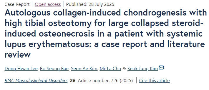 自體膠原誘導(dǎo)軟骨形成聯(lián)合脛骨高位截骨術(shù)治療系統(tǒng)性紅斑狼瘡患者大面積塌陷性類固醇性骨壞死：病例報告及文獻(xiàn)綜述