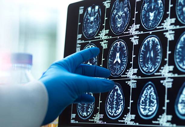 神經(jīng)干細(xì)胞移植十大常見問題解答：從原理到術(shù)后護(hù)理全知道