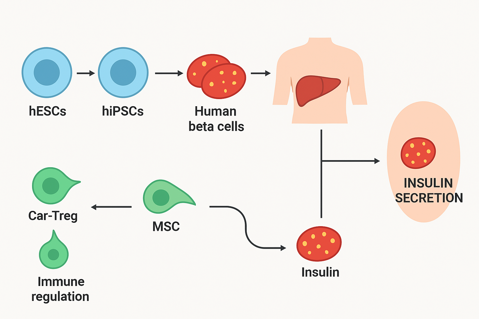 新研究有望終結胰島素注射！《糖尿病研究雜志》：干細胞療法可功能性治愈1型糖尿病