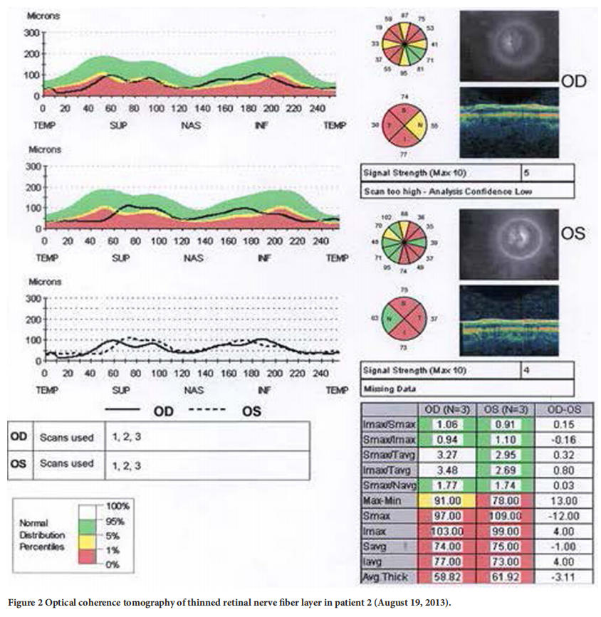 遺傳性視神經病變臨床試驗