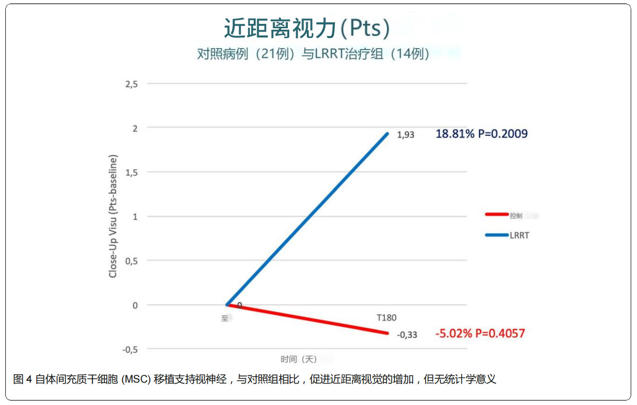 青光眼臨床試驗(yàn)