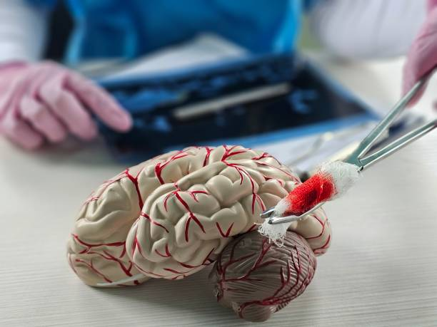 “開關現象”能解決？干細胞為帕金森病治療帶來新希望