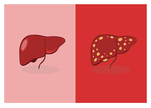 國內(nèi)外干細(xì)胞治療肝硬化進(jìn)展對比：哪項技術(shù)更成熟、效果更好？