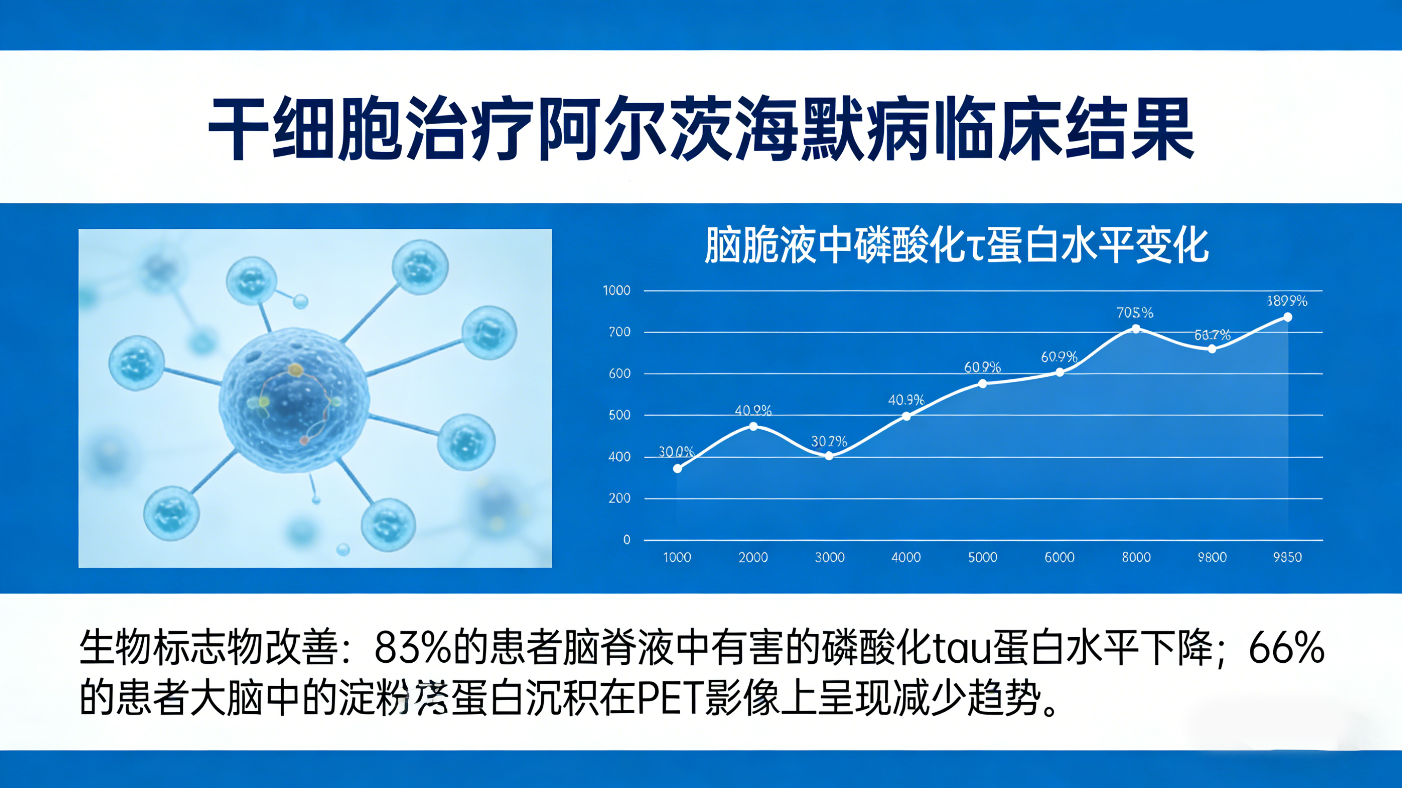 干細胞治療阿爾茨海默病臨床結果