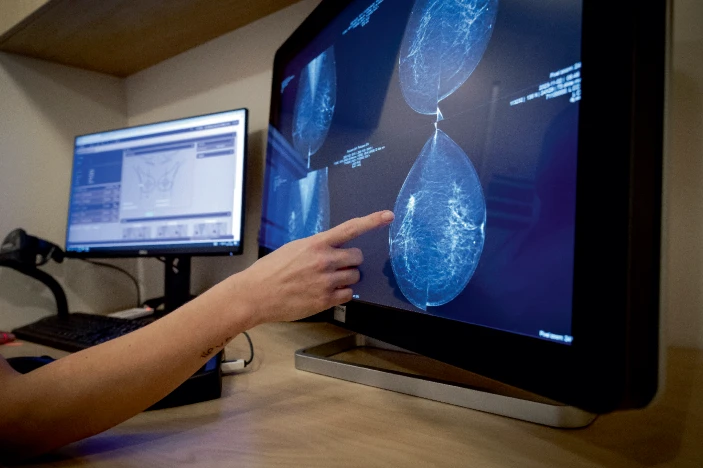 轉(zhuǎn)移性乳腺癌患者迫切需要新的治療方法。