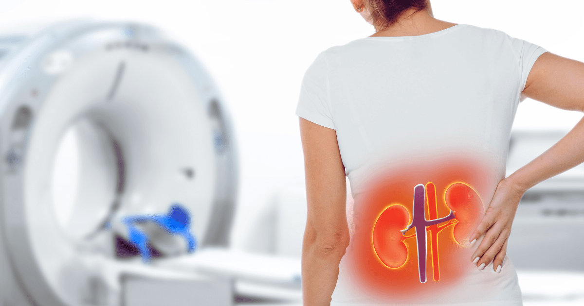 2025年1-12月：干細胞治療狼瘡性腎炎最新臨床進展匯總