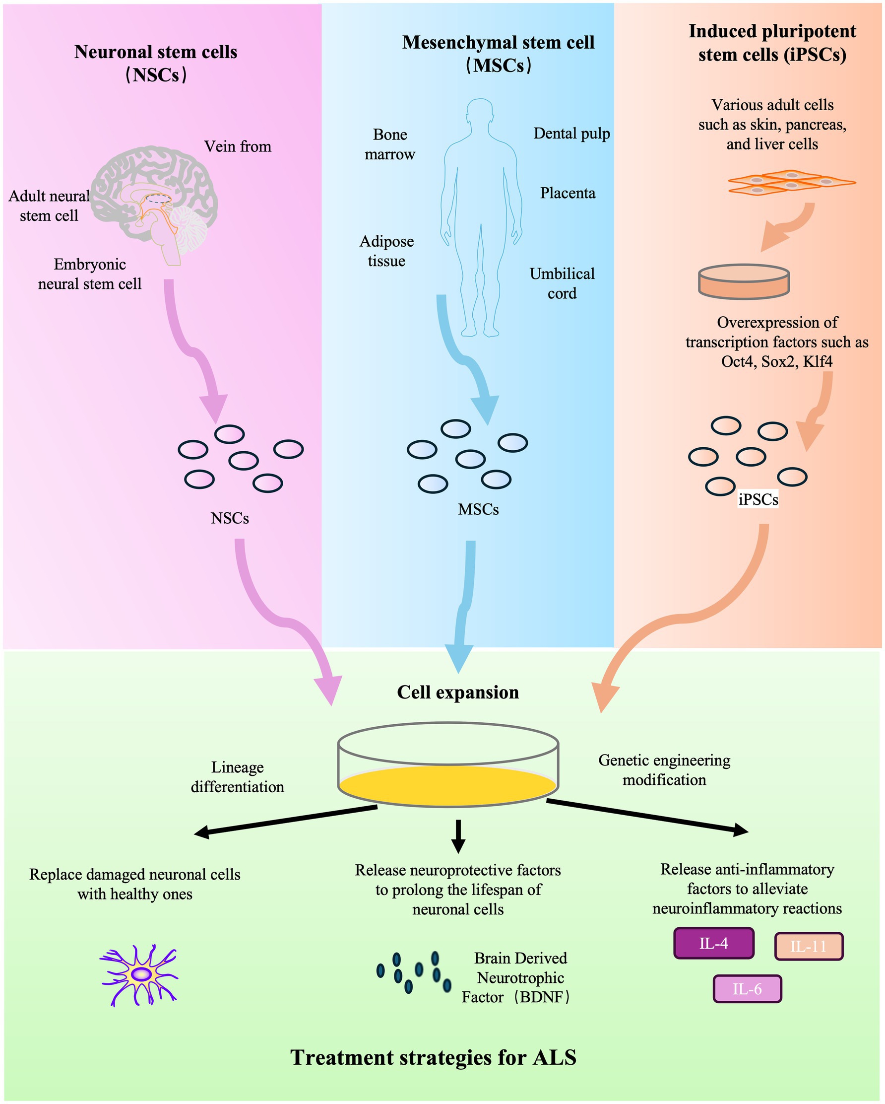 圖2：干細胞療法治療ALS的示意圖。
